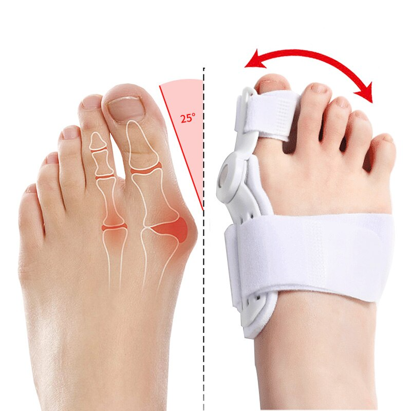 ToeAligner™ - Relief From Bunions In Seconds!