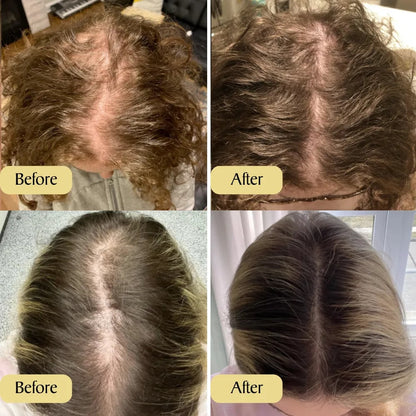 1+1 FREE | BlossomOil™ The Natural Solution For Strong, Full Hair in 45 days!