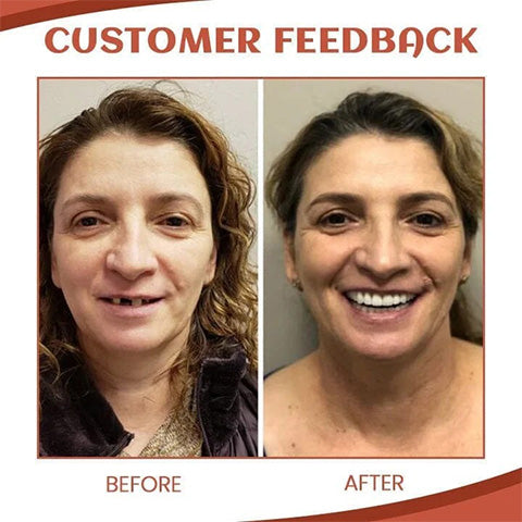 SecureSmile™ — Experience all-day pain-free security with dental prostheses