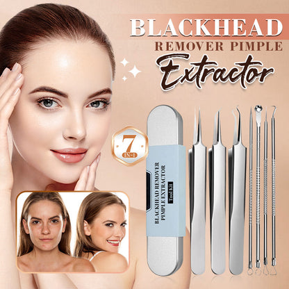 DermaTool™ – Stainless Steel Blackhead Removal Tool Set