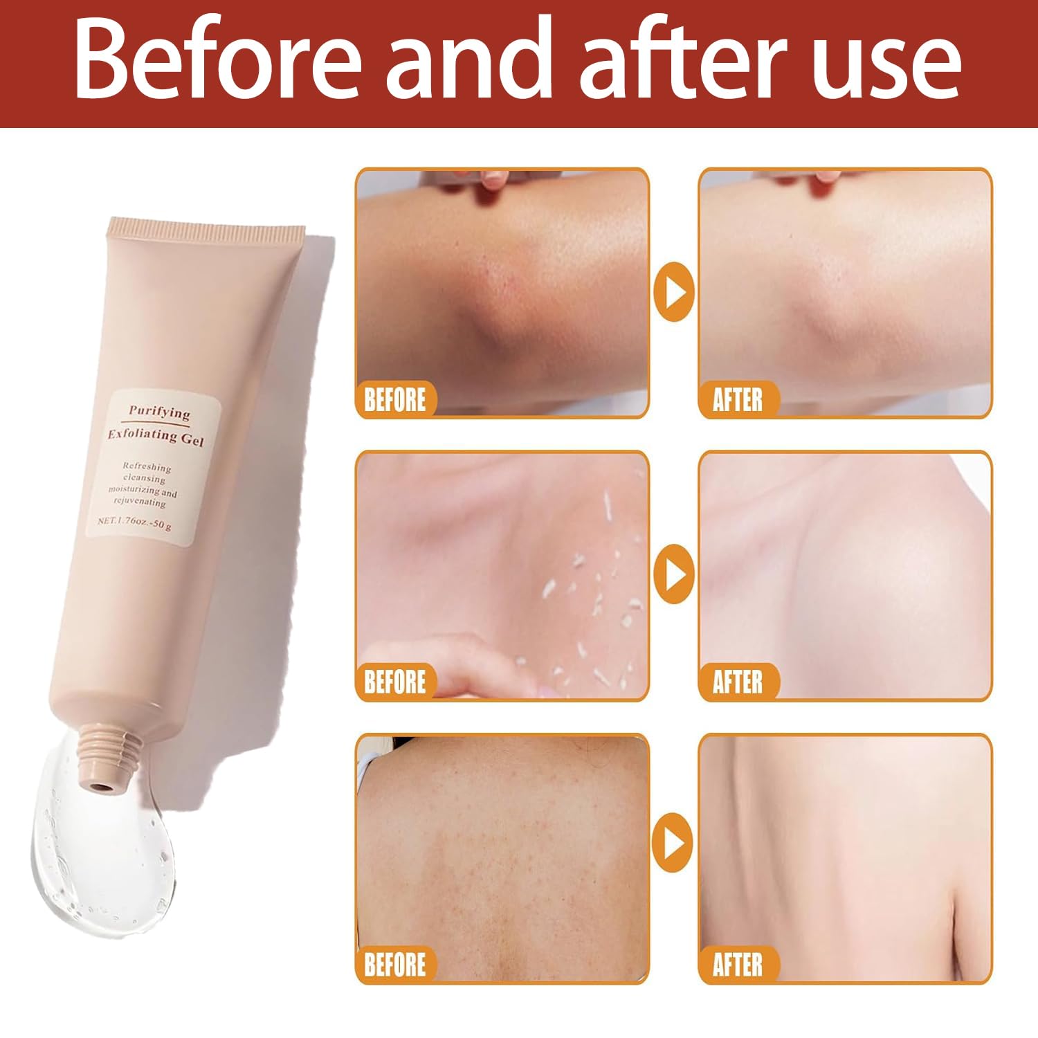 1+1 Free | LunaRadiance™ – Unleash your glow and instantly eliminate dark spots