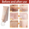 1+1 Free | LunaRadiance™ – Unleash your glow and instantly eliminate dark spots