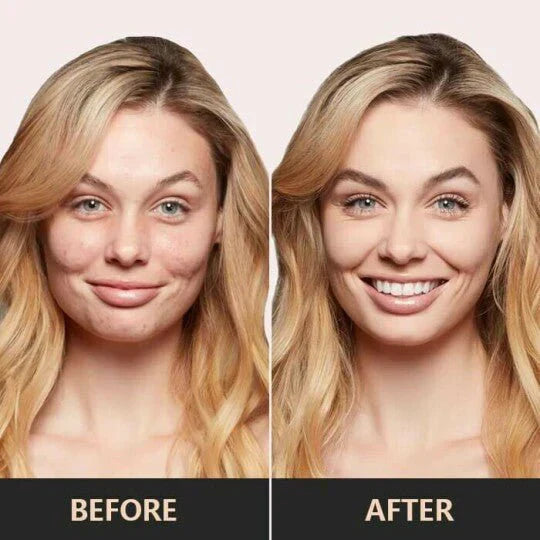 SkinNourish™ – Moisturizer for Mature Skin