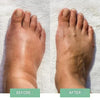 Revivax™ - The Innovative EMS Foot Massage For Instant Relief