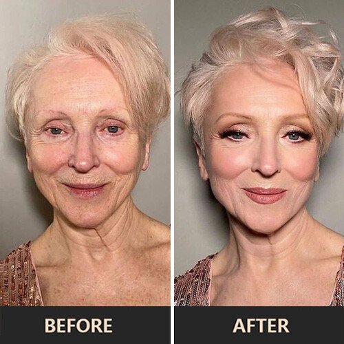 SkinNourish™ – Moisturizer for Mature Skin