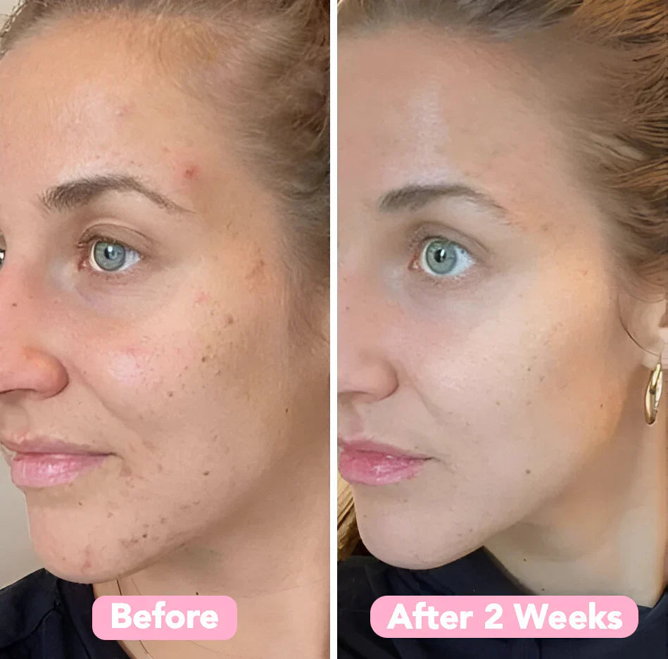 2+2 FREE | BrightEase™ – Unveil radiant, even skin that turns heads