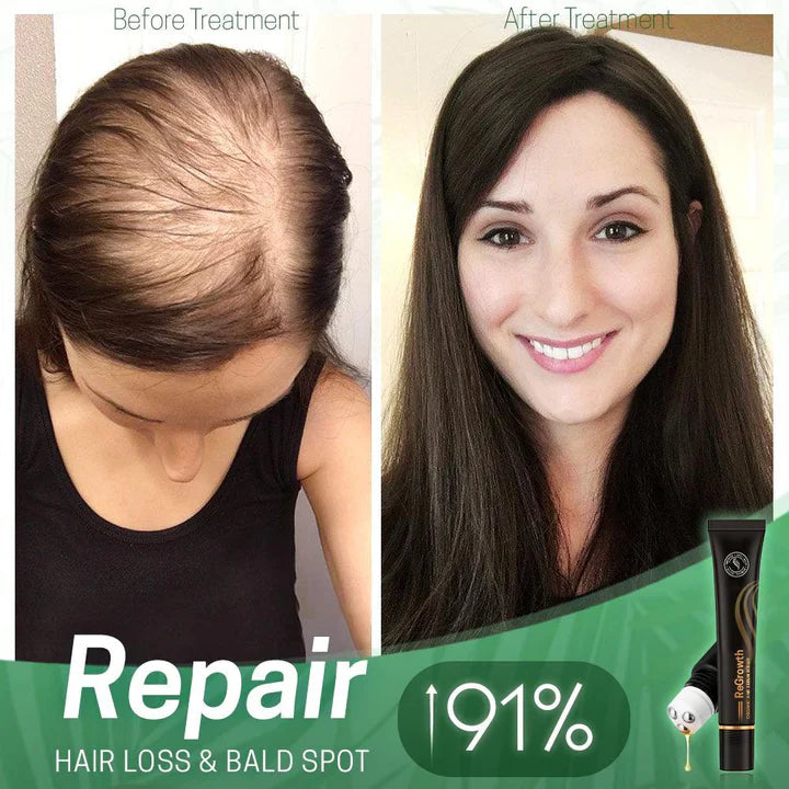 1+1 Free | NextGrow™ — Revitalize Your Hair with Stunning Shine and Strength