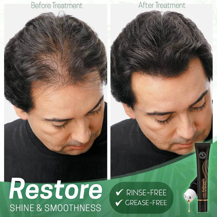 1+1 Free | NextGrow™ — Revitalize Your Hair with Stunning Shine and Strength