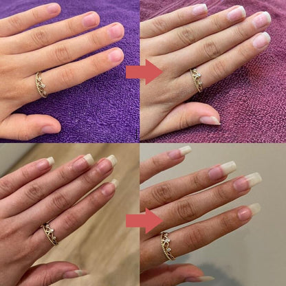 1+1 FREE | Nailixir™ Discover The Secret Of Healthy Nails!