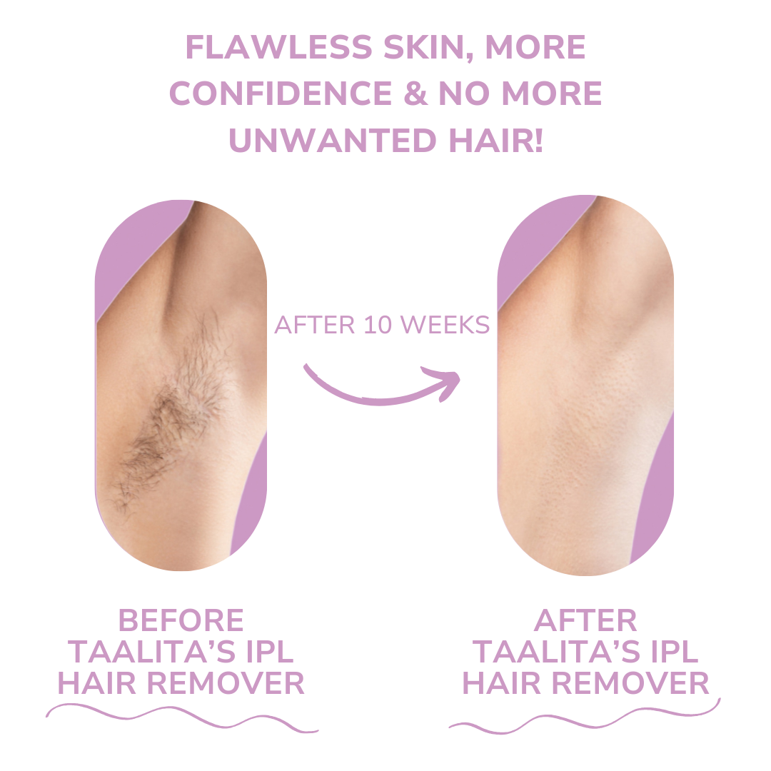LumaSilk™ – Pain-Free Silky Smoothness That Boosts Your Confidence Every Day