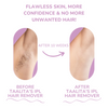 LumaSilk™ – Pain-Free Silky Smoothness That Boosts Your Confidence Every Day