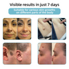 LumiRaze™ — Quickly removes skin imperfections and reveals radiant confidence