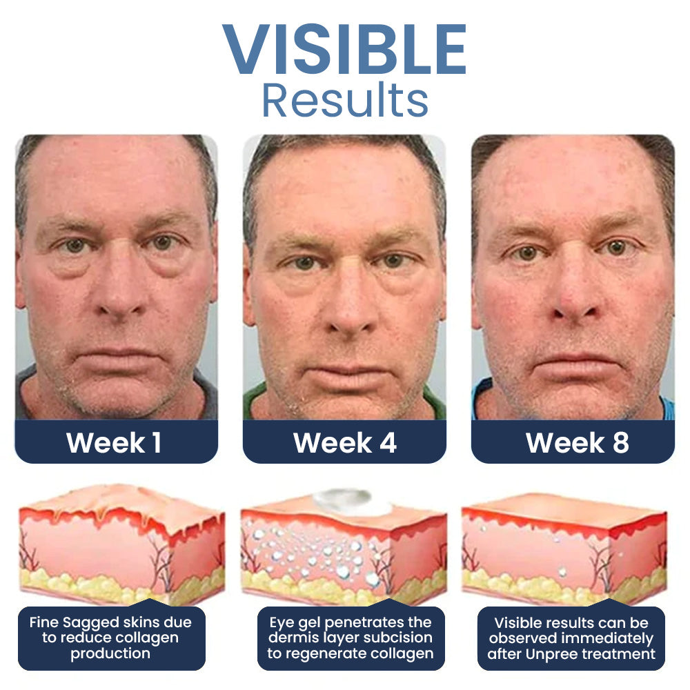 1+1 FREE | Luminize™ A clinically proven solution for annoying eye wrinkles and fine lines