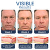 1+1 FREE | Luminize™ A clinically proven solution for annoying eye wrinkles and fine lines