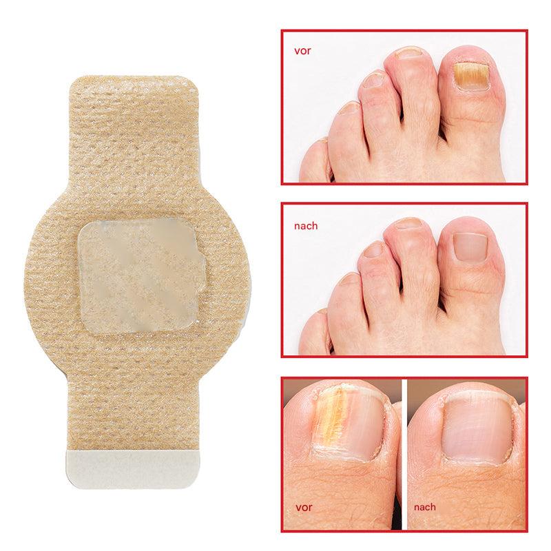 1+1 FREE | Nailox™ Plant-Based Formula That Penetrates Deep to Heal and Renew Nails