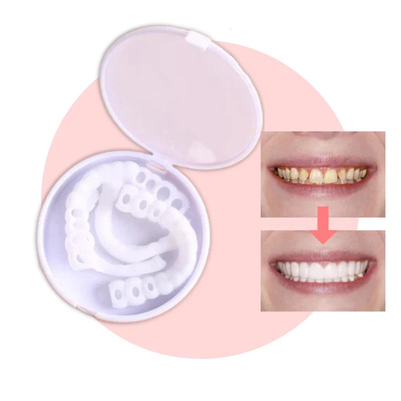 Snap-On™ - Always A Perfect Smile With These Veneers