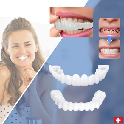 Snap-On™ - Always A Perfect Smile With These Veneers