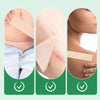 ScarGuard™ – Effective Scar Treatment